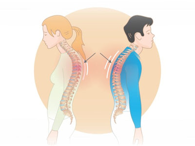 Posture and Dowager Hump